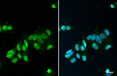 Anti-FUS antibody [HL2454] used in Immunocytochemistry/ Immunofluorescence (ICC/IF). GTX638772