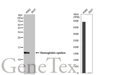 Anti-Hemoglobin epsilon antibody [HL2457] used in Western Blot (WB). GTX638775
