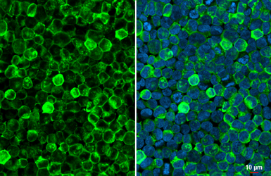 Anti-Hemoglobin epsilon antibody [HL2457] used in Immunocytochemistry/ Immunofluorescence (ICC/IF). GTX638775