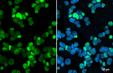 Anti-Rb antibody [HL2465] used in Immunocytochemistry/ Immunofluorescence (ICC/IF). GTX638814