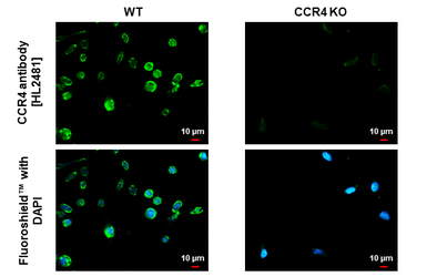 Anti-CCR4 antibody [HL2481] used in Immunocytochemistry/ Immunofluorescence (ICC/IF). GTX638830