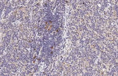 Anti-CCR4 antibody [HL2481] used in IHC (Paraffin sections) (IHC-P). GTX638830