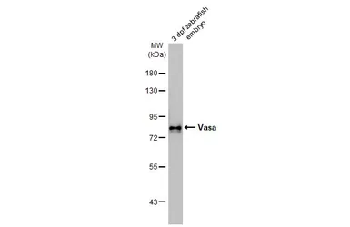Anti-Vasa antibody [HL2485] used in Western Blot (WB). GTX638835