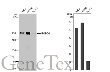 Anti-ROBO1 antibody [HL2559] used in Western Blot (WB). GTX638936