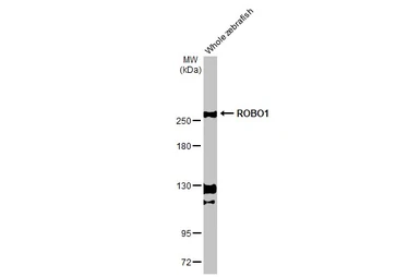 Anti-ROBO1 antibody [HL2559] used in Western Blot (WB). GTX638936