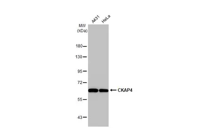 Anti-CKAP4 antibody [HL2562] used in Western Blot (WB). GTX638940