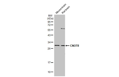 Anti-CNOT8 antibody [HL2586] used in Western Blot (WB). GTX639037