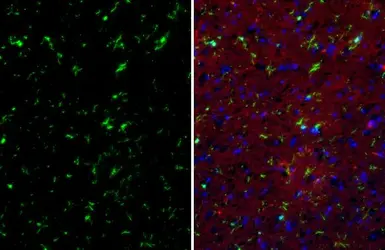 Anti-TMEM119 antibody [HL2627] used in IHC (Paraffin sections) (IHC-P). GTX639083