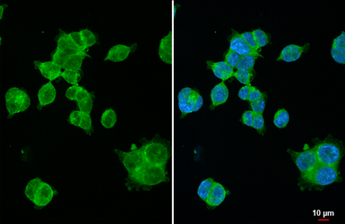 Anti-XPR1 antibody [HL2631] used in Immunocytochemistry/ Immunofluorescence (ICC/IF). GTX639087