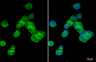 Anti-XPR1 antibody [HL2632] used in Immunocytochemistry/ Immunofluorescence (ICC/IF). GTX639088