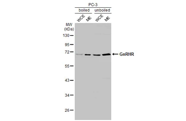 Anti-GnRHR antibody [HL2638] used in Western Blot (WB). GTX639094