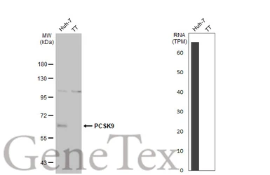 Anti-PCSK9 antibody [HL2666] used in Western Blot (WB). GTX639330