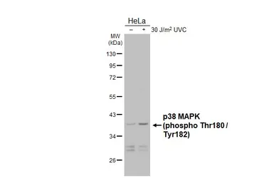 Anti-p38 MAPK (phospho Thr180 / Tyr182) antibody [HL2741] used in Western Blot (WB). GTX639570