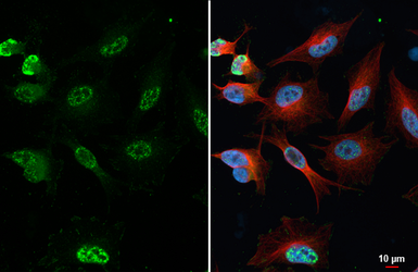 Anti-p38 MAPK (phospho Thr180 / Tyr182) antibody [HL2741] used in Immunocytochemistry/ Immunofluorescence (ICC/IF). GTX639570