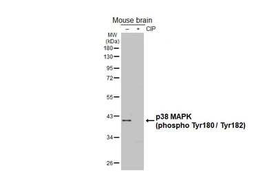 Anti-p38 MAPK (phospho Thr180 / Tyr182) antibody [HL2742] used in Western Blot (WB). GTX639571