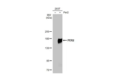 Anti-PER2 antibody [HL2775] used in Western Blot (WB). GTX639640