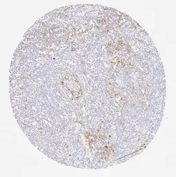 Anti-PD-L1 antibody [H302] HistoMAX&trade; used in IHC (Paraffin sections) (IHC-P). GTX639925