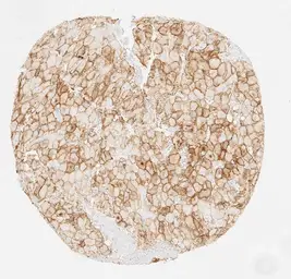 Anti-PD-L1 antibody [H302] HistoMAX&trade; used in IHC (Paraffin sections) (IHC-P). GTX639925