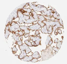 Anti-PD-L1 antibody [H302] HistoMAX&trade; used in IHC (Paraffin sections) (IHC-P). GTX639925