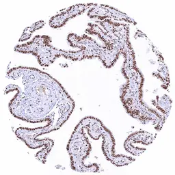 Anti-KDM6A antibody [HMV311] HistoMAX&trade; used in IHC (Paraffin sections) (IHC-P). GTX639935