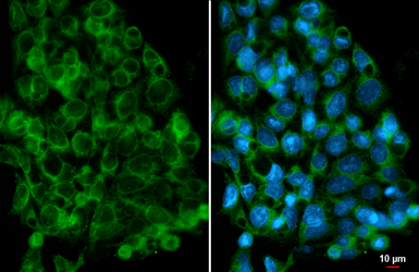 Anti-AMFR antibody [HL2866] used in Immunocytochemistry/ Immunofluorescence (ICC/IF). GTX640143