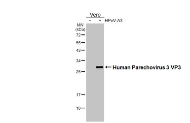 Anti-Human Parechovirus 1+3 VP3 antibody [HL2443] used in Western Blot (WB). GTX640154