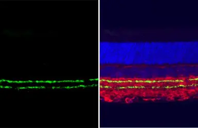 Anti-Vesicular Acetylcholine Transporter antibody [HL2900] used in IHC (Paraffin sections) (IHC-P). GTX640237