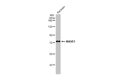 Anti-WAVE1 antibody [HL2901] used in Western Blot (WB). GTX640238