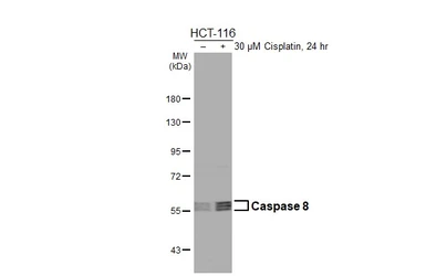 Anti-Caspase 8 antibody [HL2914] used in Western Blot (WB). GTX640257