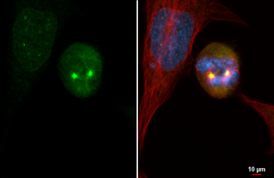 Anti-Aurora A antibody [HL2917] used in Immunocytochemistry/ Immunofluorescence (ICC/IF). GTX640260