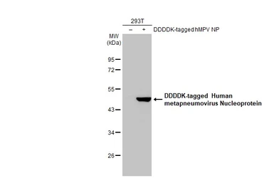 Anti-Human metapneumovirus Nucleoprotein antibody [HL2921] used in Western Blot (WB). GTX640264