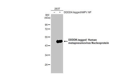 Anti-Human metapneumovirus Nucleoprotein antibody [HL2924] used in Western Blot (WB). GTX640267