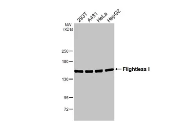 Anti-Flightless I antibody [HL2965] used in Western Blot (WB). GTX640352