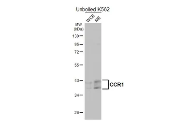 Anti-CCR1 antibody [HL3034] used in Western Blot (WB). GTX640472