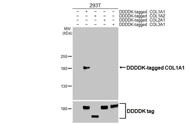 Anti-COL1A1 antibody [HL3040] used in Western Blot (WB). GTX640483