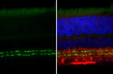 Anti-Vesicular Acetylcholine Transporter antibody [HL3053] used in IHC (Paraffin sections) (IHC-P). GTX640496