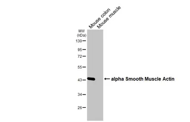 Anti-alpha Smooth Muscle Actin antibody [HL3085] used in Western Blot (WB). GTX640531