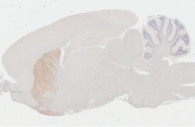 Anti-Dopamine Receptor D2 antibody [HL3159] used in IHC (Paraffin sections) (IHC-P). GTX640669
