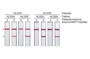 Anti-Mycoplasma pneumoniae P1 protein antibody [HL3204] used in Lateral Flow (Lateral Flow). GTX640844