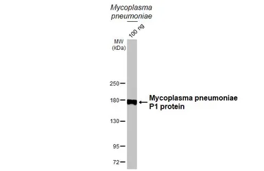 Anti-Mycoplasma pneumoniae P1 protein antibody [HL3205] used in Western Blot (WB). GTX640845