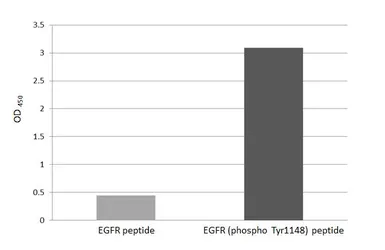Anti-EGFR (phospho Tyr1148) antibody [HL3278] used in  (). GTX640932