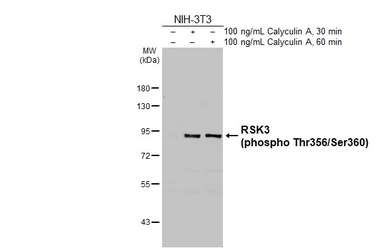 Anti-RSK3 (phospho Thr356/Ser360) antibody [HL3299] used in Western Blot (WB). GTX640988