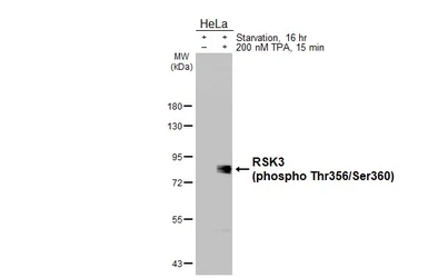Anti-RSK3 (phospho Thr356/Ser360) antibody [HL3299] used in Western Blot (WB). GTX640988