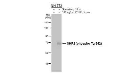 Anti-SHP2 (phospho Tyr542) antibody [HL3302] used in Western Blot (WB). GTX640991