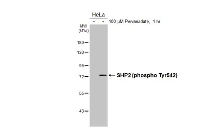Anti-SHP2 (phospho Tyr542) antibody [HL3302] used in Western Blot (WB). GTX640991