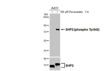 Anti-SHP2 (phospho Tyr542) antibody [HL3334] used in Western Blot (WB). GTX641099