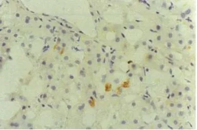 Anti-Hepatitis C virus Core Antigen antibody [H6-29] (Biotin) used in Immunohistochemistry (IHC). GTX64114