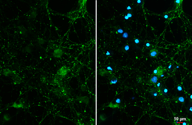 Anti-VGluT1 antibody [GT34] used in Immunocytochemistry/ Immunofluorescence (ICC/IF). GTX641142