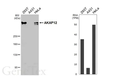 Anti-AKAP12 antibody [HL3364] used in Western Blot (WB). GTX641184