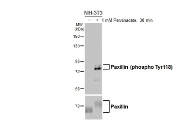 Anti-Paxillin (phospho Tyr118) antibody [HL3384] used in Western Blot (WB). GTX641204